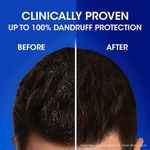 Buy Head and Shoulders Anti Hair Fall Shampoo, 340 ml - Purplle