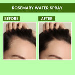 Buy Alps Goodness X DERMDOC Bestselling Sprays Duo I Rosemary Water Spray (100 ml) + 5% Glycolic Acid Under Arm Treatment Spray (100 ml) I Hair Growth Expert I Underarm Brightening Combo of 2 - Purplle