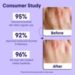 Buy Aravi Organic 10% AHA + BHA Body Lotion For Exfoliation - Treats Strawberry Legs & Bumpy Skin With Ceramide - 200 ml - Purplle