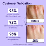 Buy Aravi Organic 10% AHA + 1% BHA Exfoliating Body Lotion For Dry Skin | Strawberry Legs & Bumpy Skin | Brightening with Niacinamide, Ceramide & Shea Butter | 200 ml - Purplle
