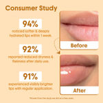 Buy Aravi Organic Lip Glowy Balm with SPF 50 PA+++ | Enriched with Kojic Acid, Ceramide & Peptide | Brightens & Hydrates Dry Lips | Soft, Healthy Lips & Sun Protection | Natural Lip Care – 5 gm - Purplle