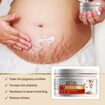 Buy Prisa Organics STRETCH MARK REMOVAL CREAM 100 gm - Purplle