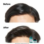 Buy L'Oreal Professionnel Scalp Advanced Anti-Oiliness Dermo-Purifier Shampoo 300 ml for Oily Scalps - Purplle