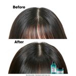 Buy L'Oreal Professionnel Scalp Advanced Anti-Oiliness Dermo-Purifier Shampoo 300 ml for Oily Scalps - Purplle