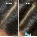 Buy L'Oreal Professionnel Scalp Advanced Anti-Oiliness Dermo-Purifier Shampoo 300 ml for Oily Scalps - Purplle