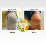 Buy Deyga Foot Cream | For Dry, Rough, And Cracked Feet | Moisturizes Rough Heels | Suits both Men & Women | 40 gm - Purplle