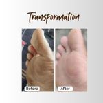 Buy Deyga Foot Cream | For Dry, Rough, And Cracked Feet | Moisturizes Rough Heels | Suits both Men & Women | 10 gm - Purplle