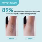 Buy Fixderma Nigrifix Underarm Ocean Roll on With 6% AHA, Lactic Acid & 1% Mandelic Acid & Kojic Acid | Brightens Skin & Exfoliates Underarm | For Sensitive Skin - 60 ml (Pack of 1) - Purplle