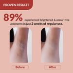 Buy Fixderma Nigrifix Underarm Velvet Musk Roll on with 6% AHA, Lactic Acid & 1% Mandelic Acid & Kojic Acid | Brightens Skin & Exfoliates Underarm | For Sensitive Skin - 60 ml (Pack of 1) - Purplle