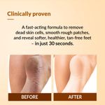 Buy Fixderma Foobetik Foot Scrub Spray with Lactic Acid | 30 sec Foot Facial Spray | Foot Scrubber for Dead Skin | Callus Remover Spray | Heel Scrubber for Feet | Instantly Smooth & Soft Feet - 50 ml - Purplle