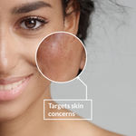 Buy Lotus Botanicals Skin Brightening Face Serum | Vitamin C | Recovers and Repairs Dull Skin | Silicon & Chemical Free | All Skin Types | 30 gm - Purplle