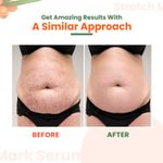 Buy Mildcares Stretch Mark Serum Roll-On With 99% Pure Sea Buckthorn For Skin Nourishment & Repair (40 ml) - Purplle