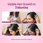 Buy Good Vibes Onion Hair Fall Control Serum with 5X Actives | Onion, 0.5% Redensyl, Biotin, Fenugreek & Green Tea| Lightweight & Non-Sticky | Strengthens Roots | Promotes Hair Growth | Visible Growth in 3 Months | Best Results with Daily - 50 ml - Purplle