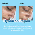Buy M&U Hyaluron Repair Healing Face Serum 20 gm - Purplle