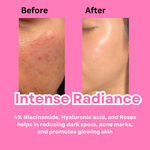 Buy M&U Intense Radiance Glowing Skin Serum 20 gm - Purplle