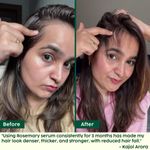 Buy PLIX - THE PLANT FIX Rosemary Hair Growth Serum with 3% Redensyl, 4% AnaGain, 3% Baicapil, 30 ml | Stimulates Hair Growth, Increase Hair Density & Thickens Hair | For Men & Women - Purplle