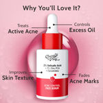 Buy CHEMIST AT PLAY ACNE CONTROL FACE SERUM 30 ML - Purplle