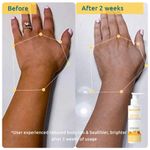 Buy WishCare Sunscreen Body Lotion SPF 50 + Aqua Fresh Under Arm Roll On Serum Combo of 2 - Purplle