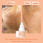 Buy WishCare Brightening Face Duo - Vitamin C Pure Glow Face Sunscreen & Super Bright C16 Vitamin C Face Serum Combo of 2 - Purplle