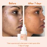 Buy WishCare Brightening Face Duo - Vitamin C Pure Glow Face Sunscreen & Super Bright C16 Vitamin C Face Serum Combo of 2 - Purplle
