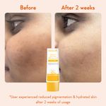 Buy WishCare Brightening Face Duo - Vitamin C Pure Glow Face Sunscreen & Super Bright C16 Vitamin C Face Serum Combo of 2 - Purplle