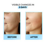Buy Streax Hydrate & Shine Face Serum with 11% Glutathione &  Hyaluronic  for Glass Skin Finish 30 ml - Purplle