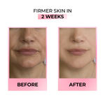 Buy Streax Youthful Shine Face Serum with 11% Retinol Peptide Complex, Reduces Dark Spots,Blemishes & Wrinkles 30 ml - Purplle