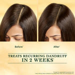 Buy Indulekha Svetakutuja Dandruff Treatment Scalp Serum 30 ml |Ayurvedic serum for dandruff treatment - Purplle