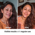Buy DERMDOC 10% Vitamin C Face Serum Glow Pods (Pack of 20 * 0.5ml Each) | Potent Face Serum Sachets | Travel-Friendly | Brightening | Fights Dark Spots, Pigmentation & Dull Skin | Serum For Acne - Purplle