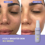 Buy SEREKO Vitamin C Clarifying Face Toner For Brightening & Pore Tightening Clears Skin with Green Tea 15ml - Purplle