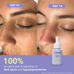 Buy SEREKO Vitamin C Clarifying Face Serum With Niacinamide for Glowing & Brightening Skin Remove Pigmentation 10ml - Purplle