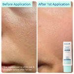 Buy WishCare Head-to-Toe Sun Protection SPF 50 PA++++ Kit with Niacinamide & Ceramide- Face, Lip & Body 255 gm - Purplle