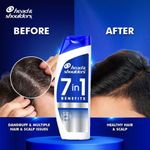 Buy Head & Shoulders 7in1 Anti-dandruff Shampoo | Multi-action formula | Complete Solution for unhealthy scalp | 7 benefits for Men and Women, 340 ml - Purplle