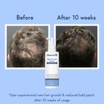 Buy WishCare Hair Growth Serum Concentrate - Resdensyl, Anagain, Caffeine, Biotin, Keratin & Rice Water 100 ml - Purplle