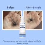 Buy WishCare Hair Growth Serum Concentrate - Resdensyl, Anagain, Caffeine, Biotin, Keratin & Rice Water 100 ml - Purplle