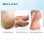 Buy Be Bodywise 20% Urea Foot Roll On - 75 ml - Purplle