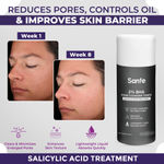 Buy Sanfe 2% BHA Pore Cleansing Toner - For Blackheads, Enlarged Pores, Wrinkles, Fine Lines, 100 ml - Purplle
