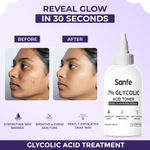 Buy Sanfe 7% Glycolic Acid Toner | Gently Exfoliates, Even Tone, Smooths Skin, Radiant Skin, 100 ml - Purplle