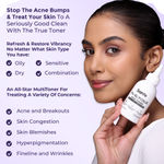 Buy Sanfe 7% Glycolic Acid Toner | Gently Exfoliates, Even Tone, Smooths Skin, Radiant Skin, 100 ml - Purplle