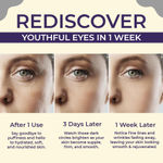 Buy Sanfe Brighten & Conceal Undereye Cream| For dark Circlers, wrinkles& Puffiness 20 gm - Purplle