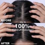 Buy Naturali Dandruff Defence Shampoo with Tea Tree Oil & Cactus Extracts | Prevents Dandruff | Paraben and Sulphate Free Shampoo | Anti Dandruff Shampoo | 370 ml - Purplle