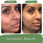 Buy Mystiq Living Tan Removal Face Scrub (100 gm) & Face Pack Green Coffee Blemish Clear (100 gm) with Kojic Acid, Anti Pigmentation, Dark Spot Removal, De tan Exfoliate Dead Skin and Blackheads , Skin Brightening & Glowing Skin For Women & Men (Combo of 2) - Purplle
