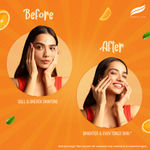 Buy Himalaya Brightening Vitamin C Serum I 5X Vitamin C & 10 X Niacinamide I Brighter Skin from Day 3 | 15 ml - Purplle