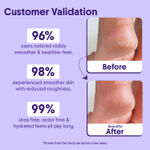 Buy Aravi Organic AHA BHA Foot Cream For Repair Cracked Heels| All Skin Types | Urea & Petroleum Free | 50 ml - Purplle