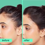 Buy PLIX - THE PLANT FIX Rosemary Advanced Anti HairFall Shampoo for Decreases Hair Fall & Breakage - 200 ml | All Hair Types | Men & Women | Sulphate & Paraben Free - Purplle