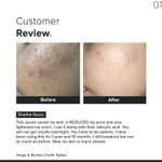 Buy Minimalist Niacinamide 10% Face Serum 60 ml - Purplle
