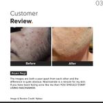 Buy Minimalist Niacinamide 10% Face Serum 60 ml - Purplle
