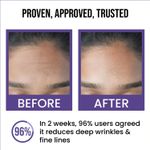 Buy Insight Cosmetics 0.5% Retinol Anti-Ageing Face Serum 30 ml - Purplle