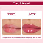 Buy DERMDOC Tint & Treat Kit (Combo of 2) | 4% Niacinamide SPF 50 PA +++ Ultra Violet Brightening Sunscreen (30 gm) | Beetroot Plumping Lip Balm (5.5 gm) - Purplle