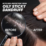 Buy Head and Shoulders Deep Cleanse Dandruff Shampoo,180 ml,Oxygenated Charcoal,Oily Scalp Dandruff Shampoo - Purplle
